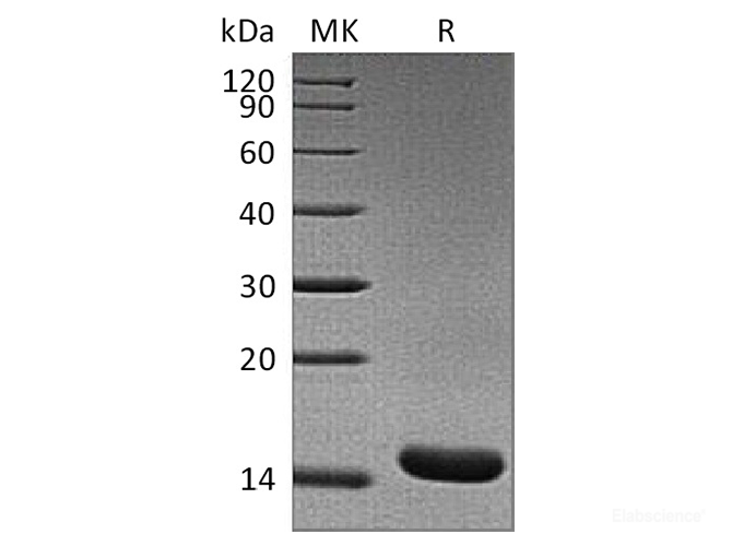 Recombinant Rat TNF-alpha / TNFSF2 / TNFa Protein-Elabscience