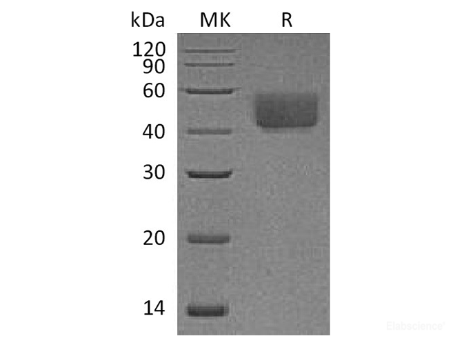 Recombinant Rat PD-L1 / B7-H1 / CD274 Protein (C-His)-Elabscience