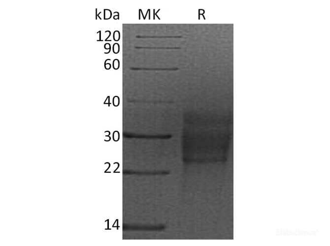 Recombinant Rat SCF / KITLG Protein (C-His)-Elabscience