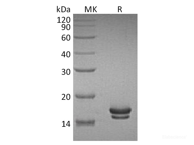 Recombinant Rat IL-2 / Interleukin-2 Protein (C-His)-Elabscience