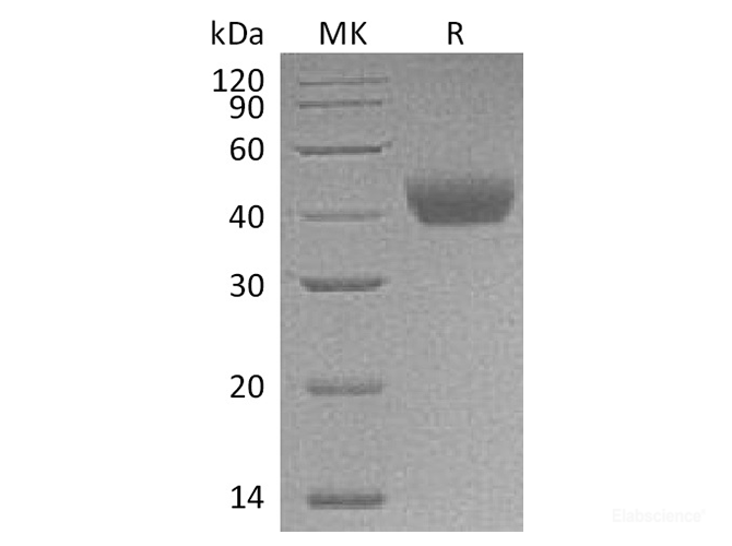 Recombinant Rat CD38 Protein (C-His)-Elabscience