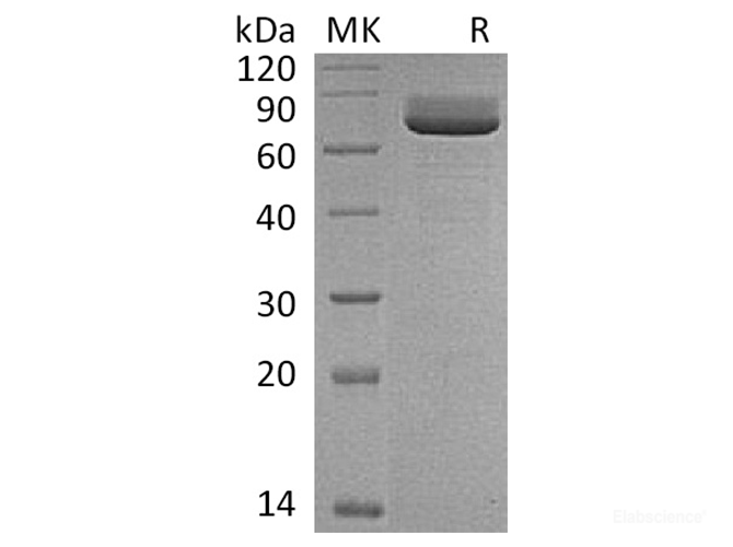 Recombinant Rat 5'-Nucleotidase / CD73 / NT5E Protein (C-His)-Elabscience