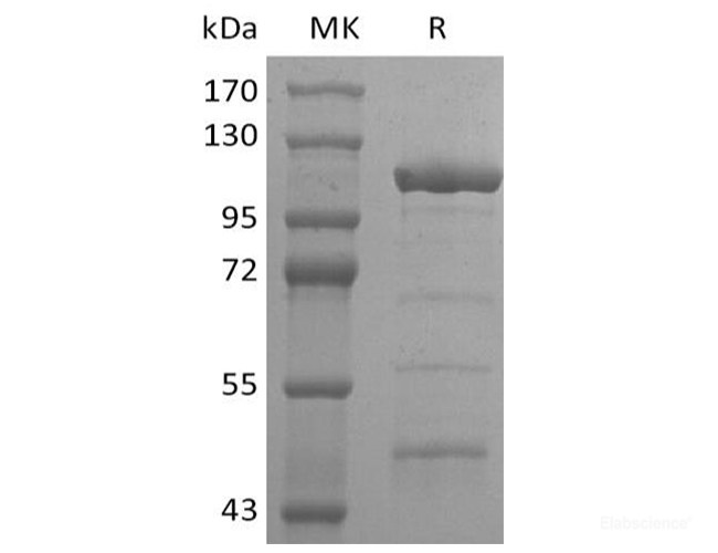 Recombinant Rat Alpha-fetoprotein Protein (His Tag)-Elabscience