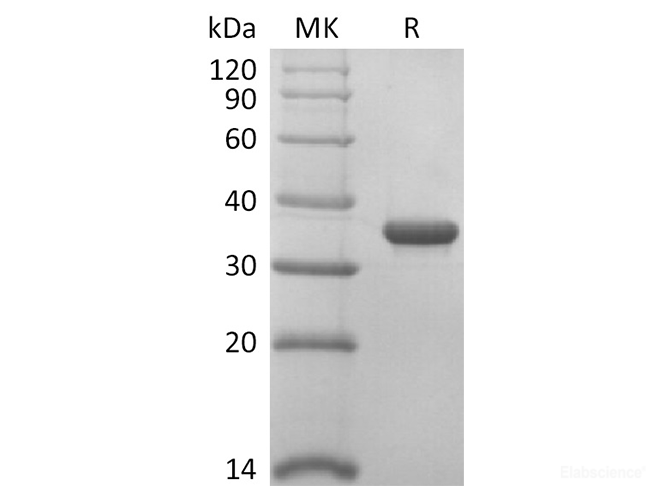 Recombinant Rat KLK10 Protein (His Tag)-Elabscience