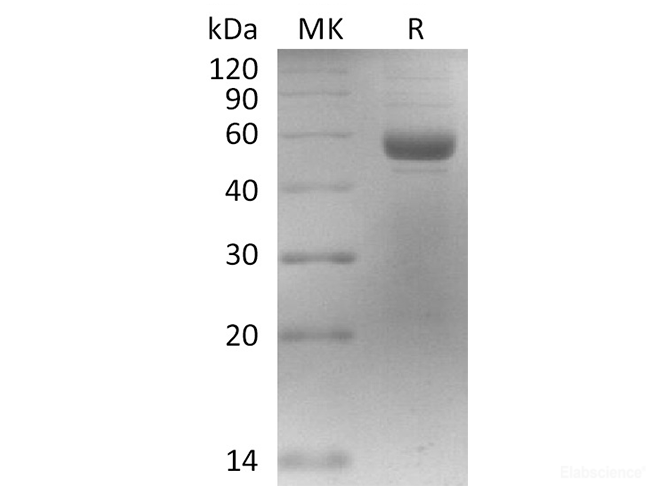 Recombinant Rat Lamin B1 Protein (His Tag)-Elabscience