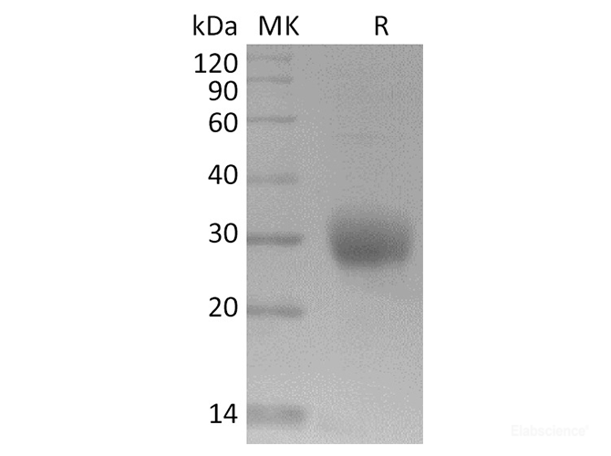 Recombinant 2019-nCoV Spike Protein (RBD, His Tag)-Elabscience