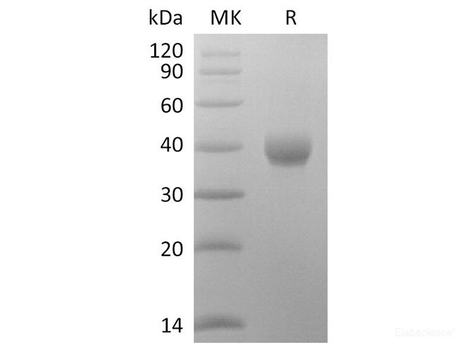 Recombinant Rat REG4 Protein (His Tag)-Elabscience