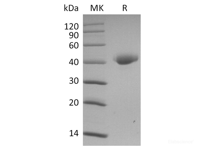 Recombinant Rat S100A9 Protein (His Tag)-Elabscience