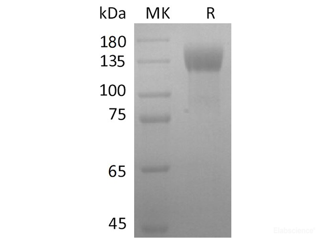 Recombinant Rat B2M/β2-MG Protein (His Tag)-Elabsicence
