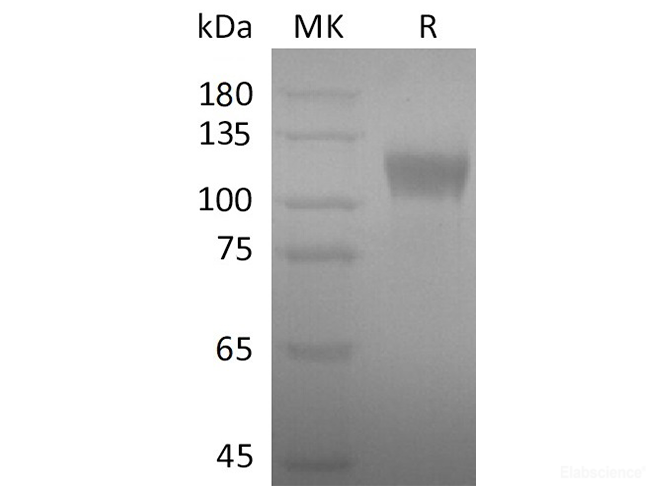 Recombinant Rat NGAL/LCN2 Protein (His Tag)-Elabsicence