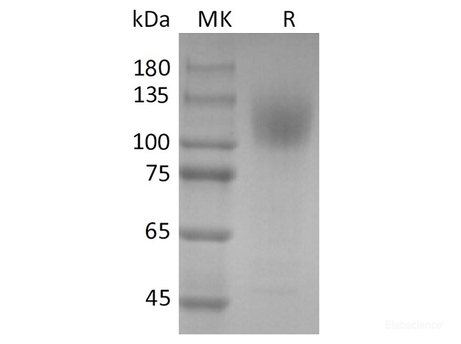 Recombinant 2019-nCoV S1 Protein (His Tag)
