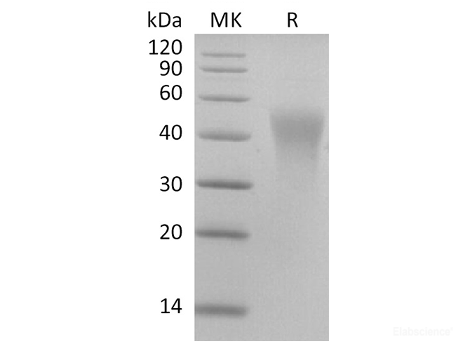 Recombinant 2019-nCoV S1 Protein (CTD, His Tag)