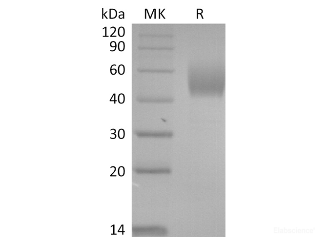 Recombinant 2019-nCoV Spike Protein (NTD, His Tag)