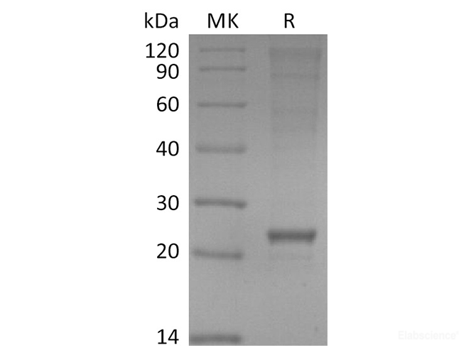 Recombinant 2019-nCoV Envelope Protein (His Tag)