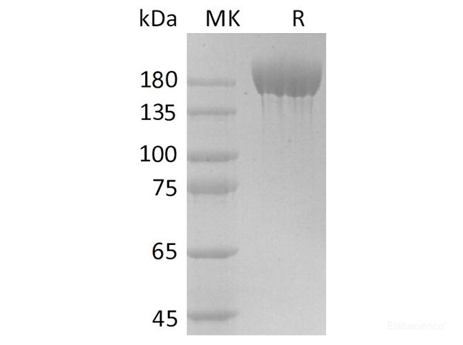 Recombinant 2019-nCoV S-trimer Protein (His Tag)