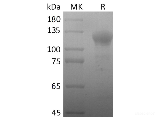 Recombinant 2019-nCoV S2 Protein (Fc Tag)