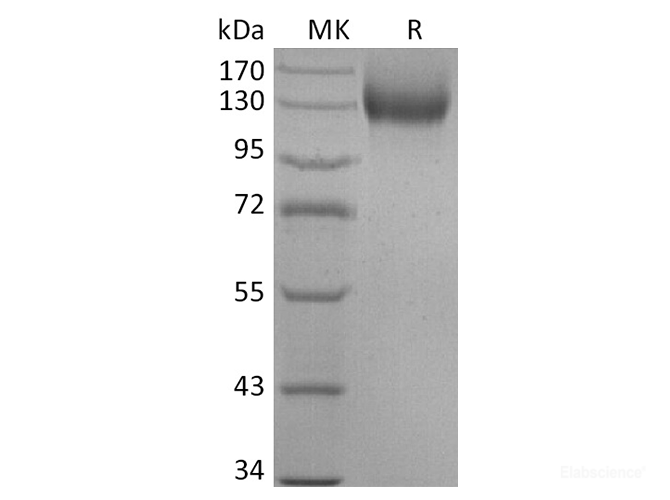 Recombinant Human ACE2 Protein (mFc Tag)