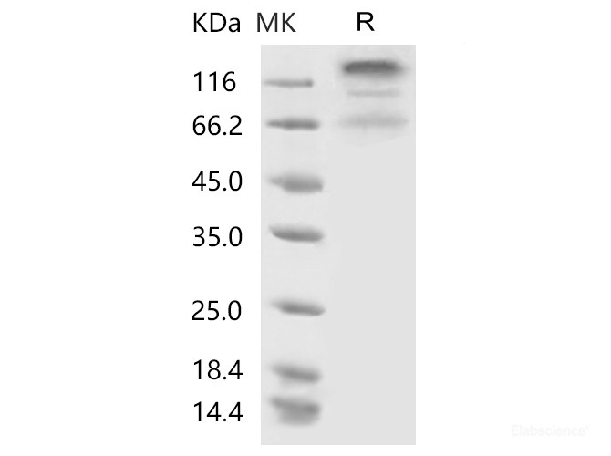 Recombinant 2019-nCoV S1+S2 Protein (ECD, His Tag)(Active)