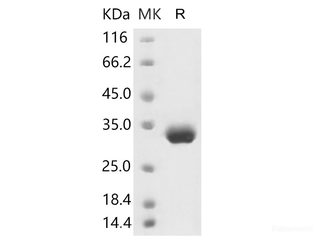 Recombinant 2019-nCoV Spike Protein (RBD, His Tag)(Active)