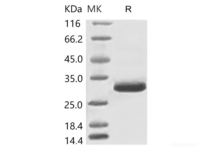 Recombinant 2019-nCoV Spike Protein, Biotinylated (RBD, His Tag)