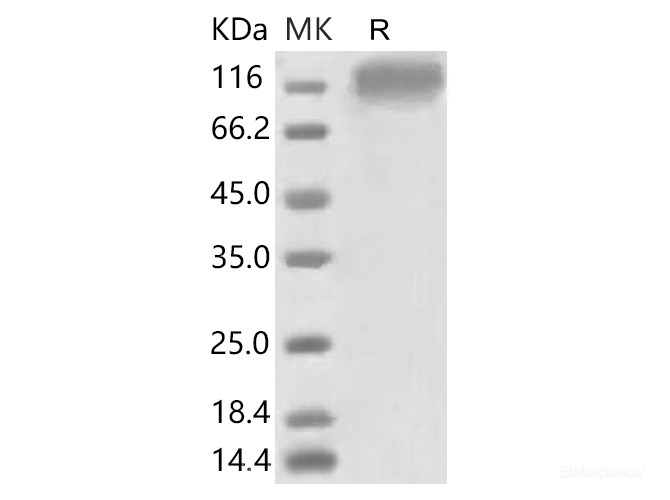 Recombinant 2019-nCoV S1 Protein (His Tag)(Active)