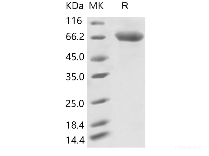 Recombinant 2019-nCoV S2 Protein (ECD, His Tag)