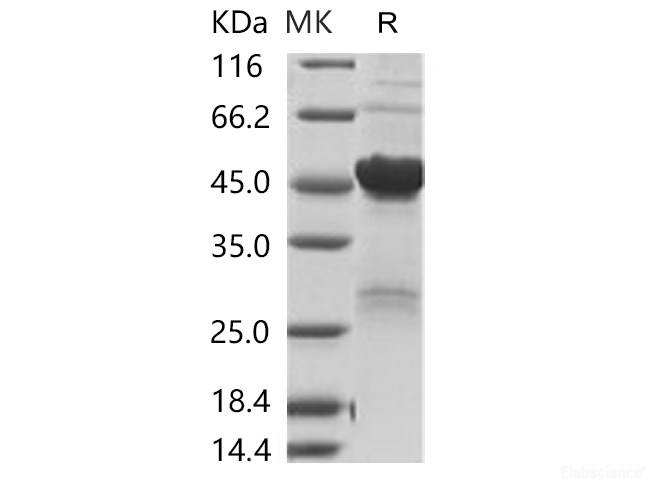 Recombinant 2019-nCoV Nucleoprotein / NP Protein (His Tag)