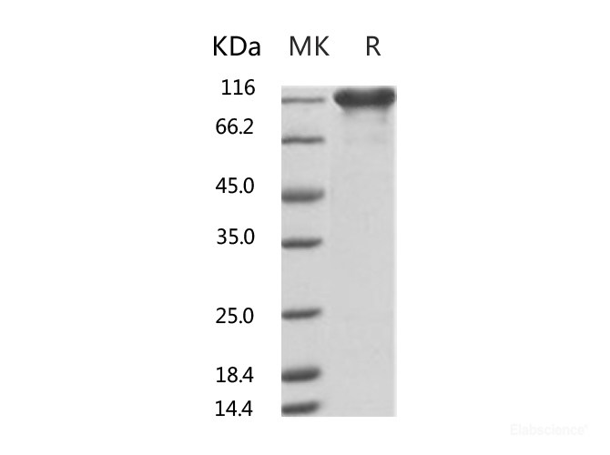 Recombinant Human ACE2 Protein (mFc Tag)-Elabscience