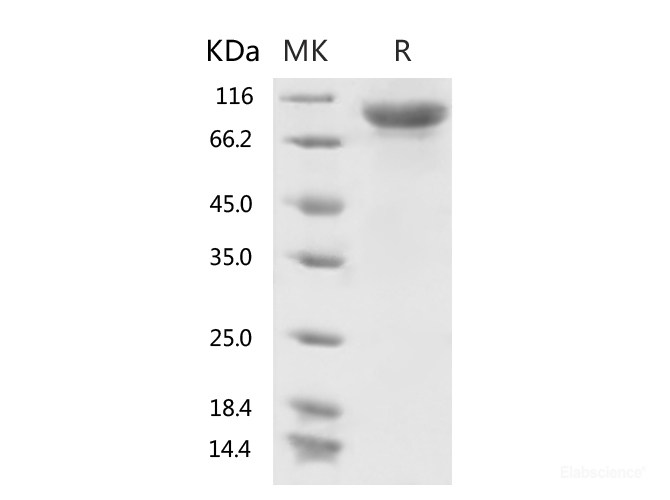 Recombinant 2019-nCoV S1 Protein (His Tag)-Elabscience