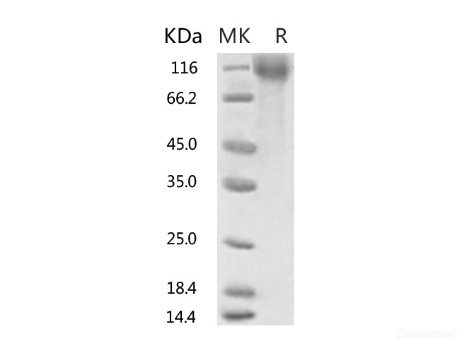Recombinant 2019-nCoV S1 Protein, Biotinylated (His Tag)-Elabscience