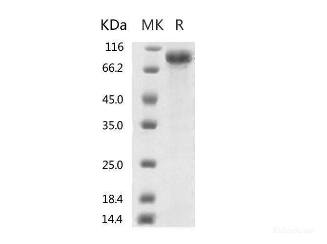 Recombinant 2019-nCoV S2 Protein  (mFc Tag)-Elabscience