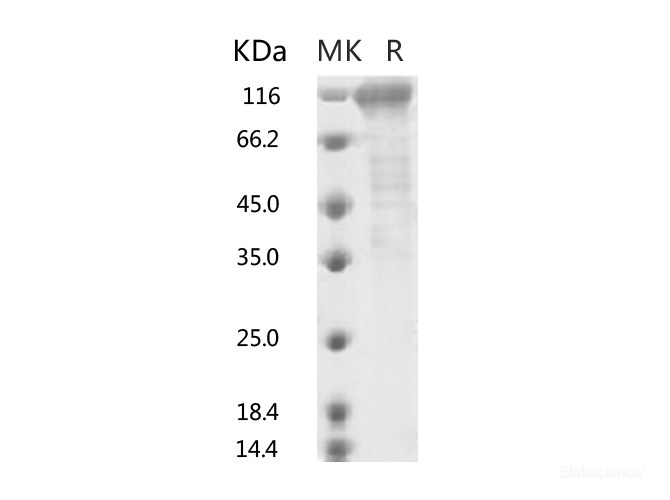 Recombinant 2019-nCoV S2 Protein (ECD, Fc Tag)-Elabscience