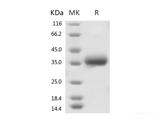 Recombinant 2019-nCoV Spike Protein (RBD, His Tag)-Elabscience