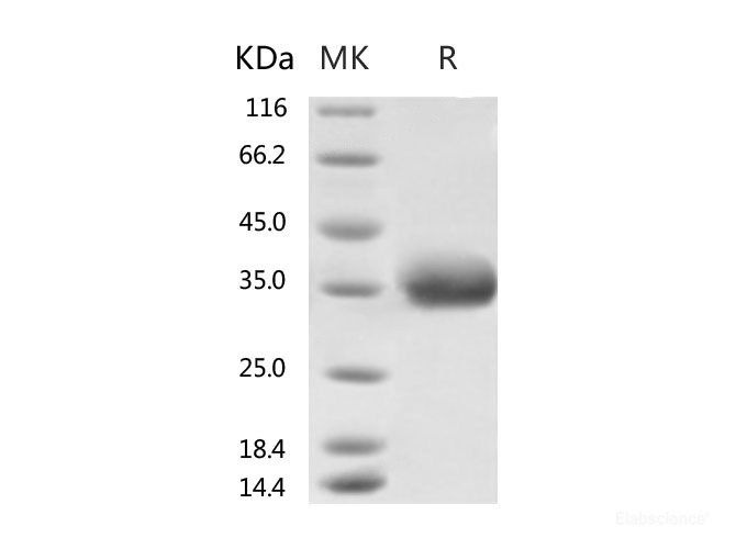 Recombinant 2019-nCoV Spike Protein, Biotinylated (RBD, His Tag)-Elabscience