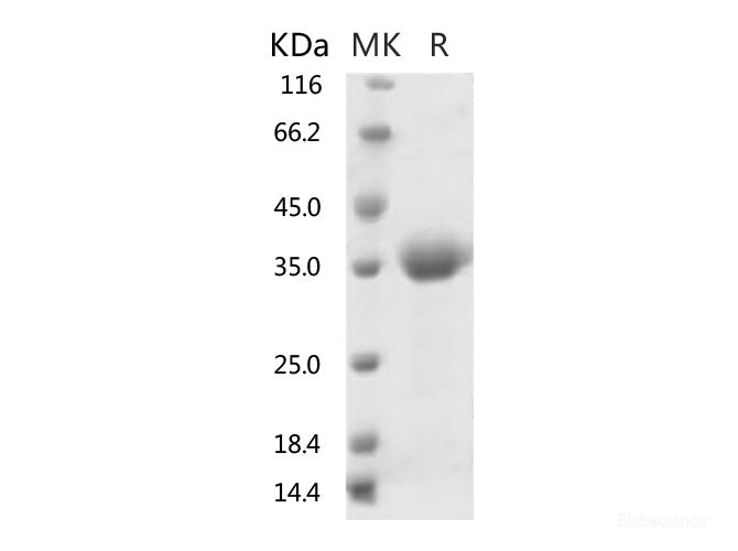 Recombinant 2019-nCoV Spike Protein (RBD)-Elabscience
