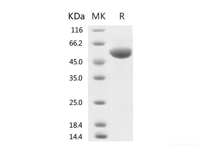 Recombinant 2019-nCoV Spike Protein (RBD, rFc Tag)-Elabscience