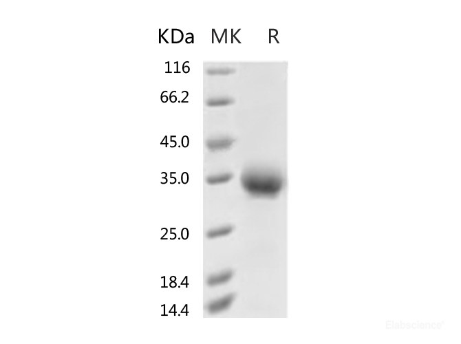 Recombinant 2019-nCoV Spike Protein (RBD, His Tag)(V367F)-Elabscience