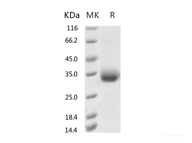 Recombinant 2019-nCoV Spike Protein (RBD, His Tag)(V483A)-Elabscience