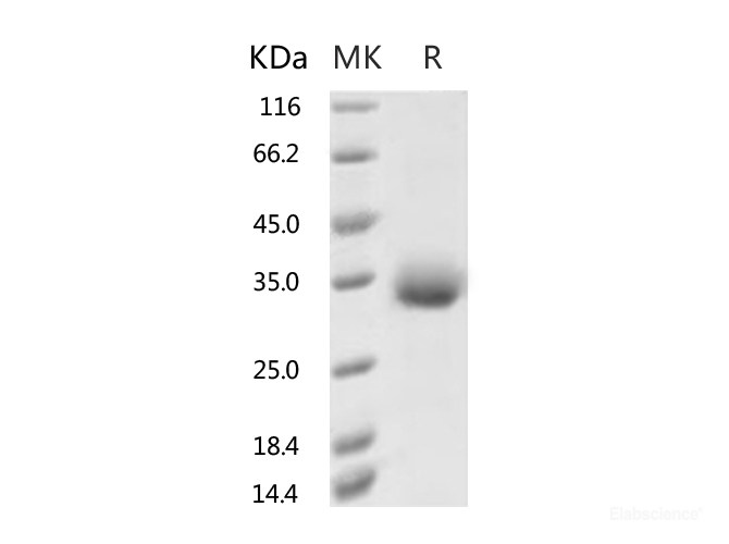 Recombinant 2019-nCoV Spike Protein (RBD, His Tag)(A435S)-Elabscience
