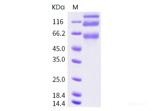 Recombinant HCoV-OC43 S1+S2 Protein (ECD, His Tag)