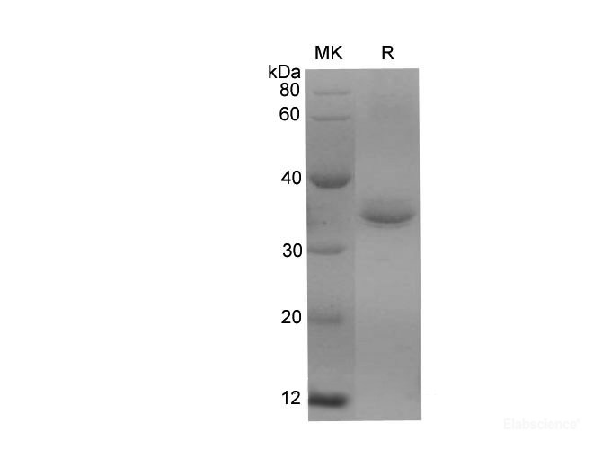 Recombinant Rat CD147/BSG/Basigin Protein (His Tag)-Elabscience