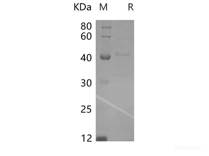 Recombinant Rat LAMP3/CD208/DC-LAMP Protein (His Tag)-Elabscience