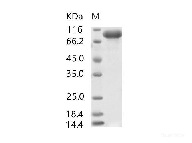 Recombinant SARS-CoV S1 Protein, Biotinylated (His Tag)