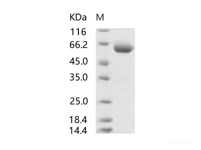 Recombinant SARS-CoV Spike Protein (RBD, mFc Tag)(Active)