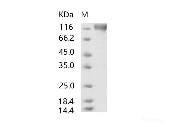 Recombinant SARS-CoV S1 Protein (mFc Tag)(Active)