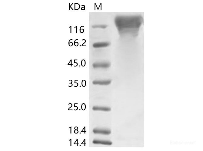 Recombinant HCoV-HKU1 (Isolate N5) S1 Protein (His Tag)