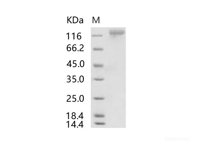 Recombinant HCoV-HKU1 (Isolate N1) S1 Protein (His Tag)