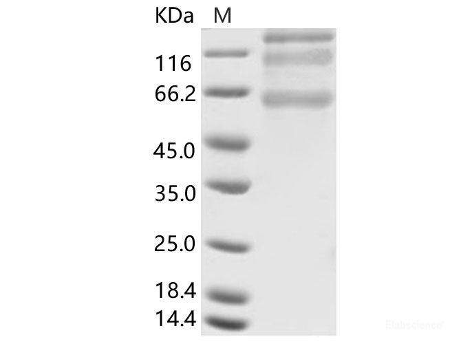 Recombinant HCoV-HKU1 (Isolate N5) S1+S2 Protein (ECD, His Tag)
