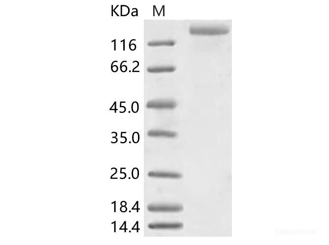 Recombinant HCoV-NL63 S1+S2 Protein (ECD, His Tag)