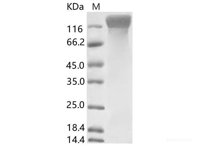 Recombinant HCoV-NL63 S1 Protein (His Tag)